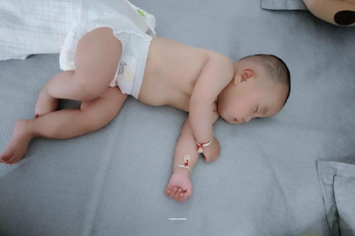 迁西六个月宝宝眼睛散光